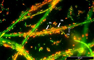 Unraveling Pseudomonas aeruginosa and Candida albicans Communication in Coinfection Scenarios: Insights Through Network Analysis